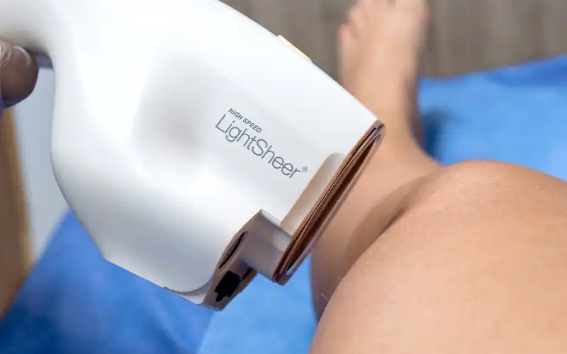 img-depilacion-laser-en-bello-1-LCP